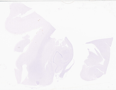 ['deident_0cfe110b-7976-4560-9f6a-19e162cda7e9_69d93838.jpg']