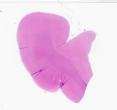 ['deident_533786f4-697c-46d7-a711-5645a244237d_69d93953.jpg']