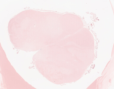 ['deident_069313fd-0233-4d22-aa13-42164b806071_69d937a2.jpg']