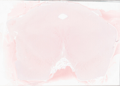 ['deident_39e0a615-0969-4a3d-83c5-208f6e42626c_69d93910.jpg']