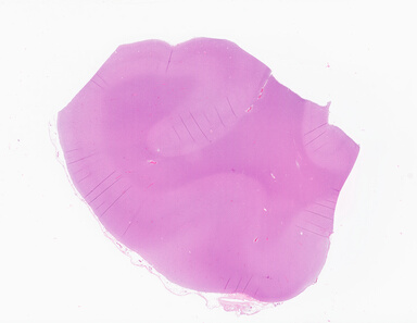['deident_972e6d45-4b54-42ba-9543-dd96f8892cdf_69d9398e.jpg']