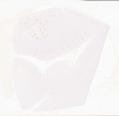 ['deident_6565f4c4-f06d-4ad3-95f6-6c74533fcfb7_69d93981.jpg']