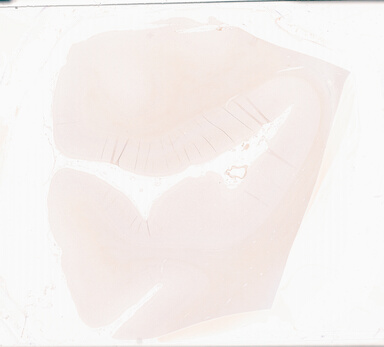 ['deident_2d32d15a-6bfe-450f-ab49-94be2b101014_69d9389b.jpg']