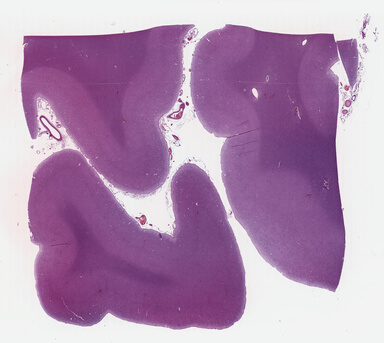 ['deident_dca8b5ce-c8d6-45ff-ba60-c0eaaedc2b70_695fc97d.jpg']