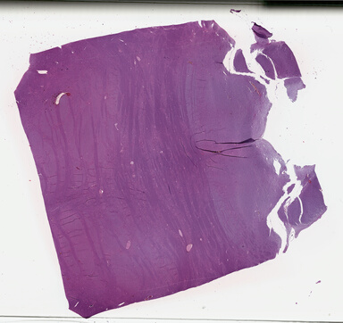 ['deident_ac466d9d-f21f-40b2-a8fc-33984af8866c_695fc96a.jpg']