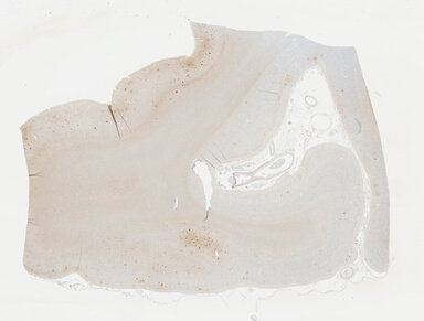 ['deident_dd492f5a-6525-4c65-afd3-781b70438d87_695fc97f.jpg']
