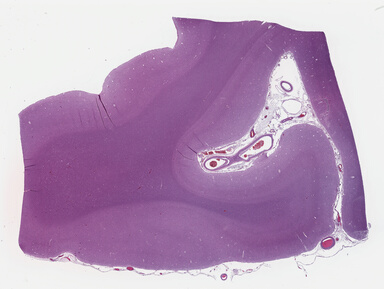 ['deident_9aac1056-dcf0-4e10-aa78-8d58c5a8345c_695fc965.jpg']