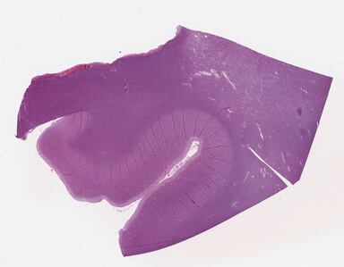['deident_7c5321fd-7bf1-483d-9453-4e0be82d08e3_695fc95a.jpg']