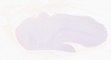 ['deident_cfd10792-83f5-496c-8781-6ea2220aa182_69d95a23.jpg']