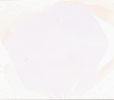 ['deident_53aa907b-1c6d-4d60-8e04-4d068693af1a_69d959de.jpg']