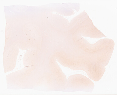 ['deident_70624277-6c91-46a4-9b34-255cbdfbc114_69d959ea.jpg']