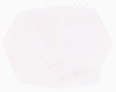['deident_202aa5fc-40ba-475c-82ef-3bd3581d20b8_69d959c6.jpg']