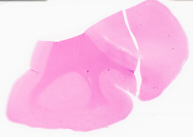 ['deident_9eeeaf79-ab01-482f-a4d1-cc3cc8f879bf_69d95a03.jpg']
