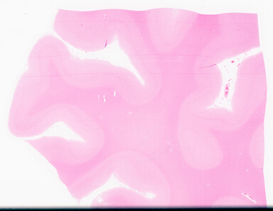 ['deident_81ce653d-d640-48a4-bd58-28dcc88f2b09_69d959f6.jpg']