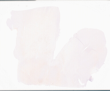['deident_78ee0ac1-a1a1-42d5-a47c-e1e86e9a1318_69d959ee.jpg']