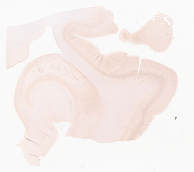 ['deident_2dfaf630-7737-4696-9444-52cd0167c5ac_69d959cb.jpg']
