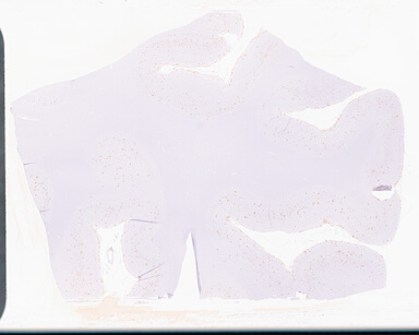 ['deident_23f67244-4746-4b27-9d3f-43ebb32611a3_69d959c8.jpg']
