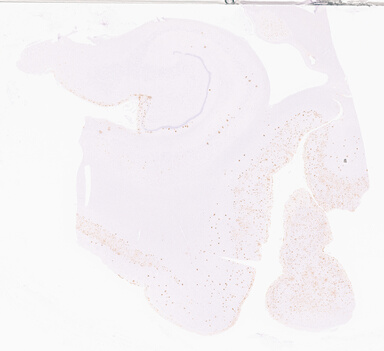 ['deident_7ff4fad4-4e46-40e9-9e43-6ddef61639c8_69d959f4.jpg']