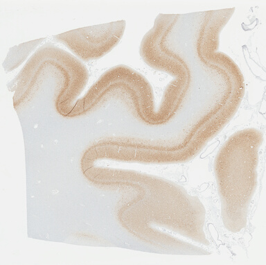['deident_46dacd5e-0212-4eec-b34a-0d4ac65b4ce4_695fd0d4.jpg']