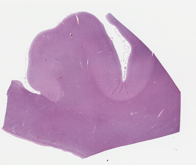 ['deident_4b366145-52bd-41eb-9531-5552f1479c20_695fd0d5.jpg']