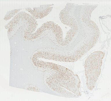 ['deident_85d6a779-0b57-48ff-961c-c80acf960549_695fd0e3.jpg']