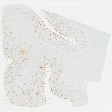 ['deident_11e5b9b8-4c00-4e03-8a51-54030a1f113f_695fd0bb.jpg']