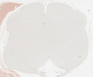['deident_9116ee9d-aeef-48a2-a913-50b44cca16c5_695fd0e7.jpg']