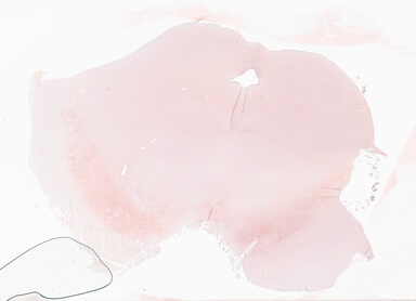 ['deident_b09a5ff1-7588-47b5-b745-0ef23d025dd7_69d927ee.jpg']