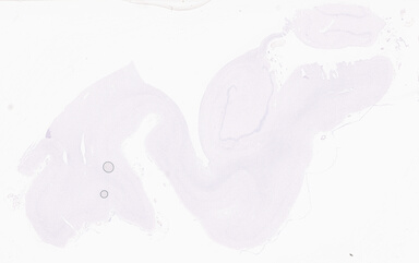 ['deident_25017220-f3a1-4caa-af22-ef6bdf1d0228_69d926e8.jpg']