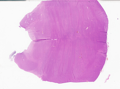['deident_ccdc7981-4455-4259-82f4-ebe9d5e6fc9a_69d927f6.jpg']