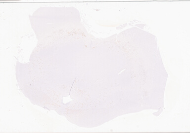 ['deident_d2f229c4-2f53-482e-8459-2ad12913e743_69d927fd.jpg']