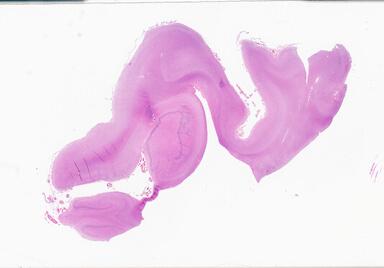 ['deident_149fc83f-1bd3-4985-af01-9c8760f02e85_69d926e1.jpg']