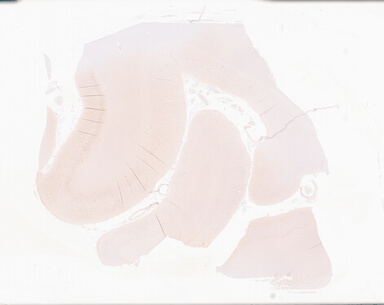 ['deident_cc856d08-ab14-43e2-8f13-997ce3c992c7_69d927f5.jpg']