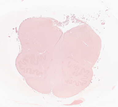 ['deident_8f76bb27-bc14-4bc0-a3ff-0b27ed87f771_69d927da.jpg']