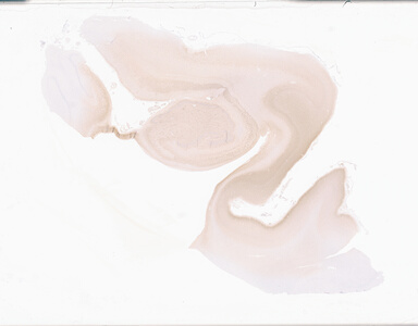 ['deident_dc47ec7b-39d8-493b-b75a-33bc47a4186b_69d92804.jpg']