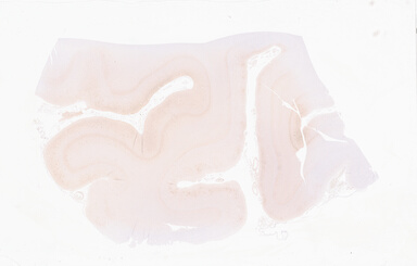 ['deident_9efd3131-4689-4967-b6c8-9fd877582811_69d927e7.jpg']