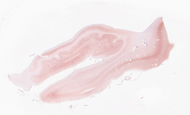 ['deident_95215446-cef1-4f44-bffd-f351892d463b_69d927de.jpg']