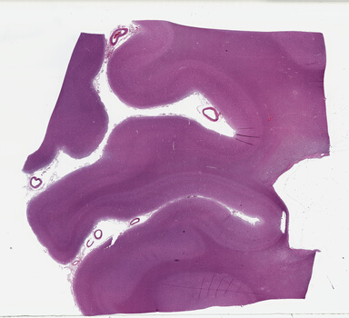 ['deident_c1c3df12-6df5-497c-ba11-0e0d47ad660a_69b04e17.jpg']
