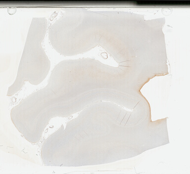 ['deident_978b958c-a521-4889-8fc4-dd9c4fe67b40_69b04e09.jpg']