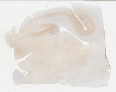 ['deident_37eb6a7d-b658-4727-9a33-184fd0454e87_69b04de4.jpg']