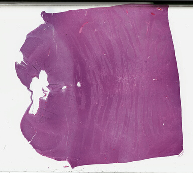 ['deident_233d2881-fa12-4062-bcc7-f9ce43f4d168_69b04ddc.jpg']