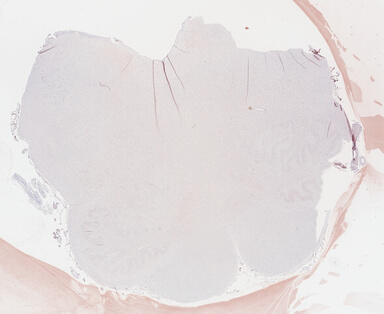 ['deident_c5ebb966-354b-42ad-af83-5dfc806dda72_69b04e1e.jpg']