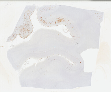 ['deident_c5264aad-ab0f-45bc-8c99-7ba33b06d5d9_69b04e1d.jpg']