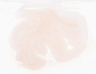 ['deident_f7ebd903-3805-40a3-b832-00dc9f238e64_69d933d4.jpg']