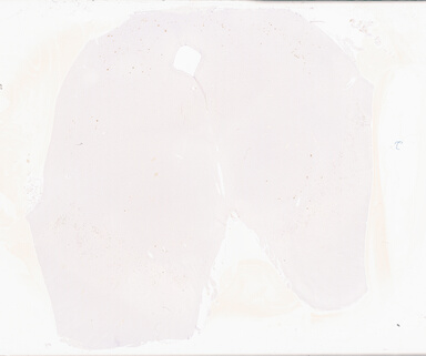 ['deident_7040731a-5100-46d4-880a-c9227322bc8c_69d93327.jpg']