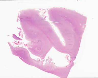 ['deident_c0903158-3563-47e0-ac79-09fa9d5fb940_69d933b8.jpg']