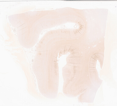 ['deident_9347727a-7237-4f1d-b35d-0848ad7901c0_69d933a7.jpg']