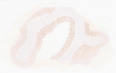 ['deident_182b7583-8a45-42a2-97cf-7c1848e88416_69d932ae.jpg']