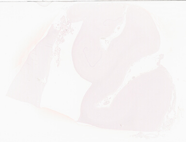 ['deident_48ba935e-8014-47e2-b454-023eb4591fb4_69d93302.jpg']