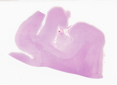 ['deident_f472becd-efaf-4e7f-adf0-8c03596e38e4_69d933c3.jpg']